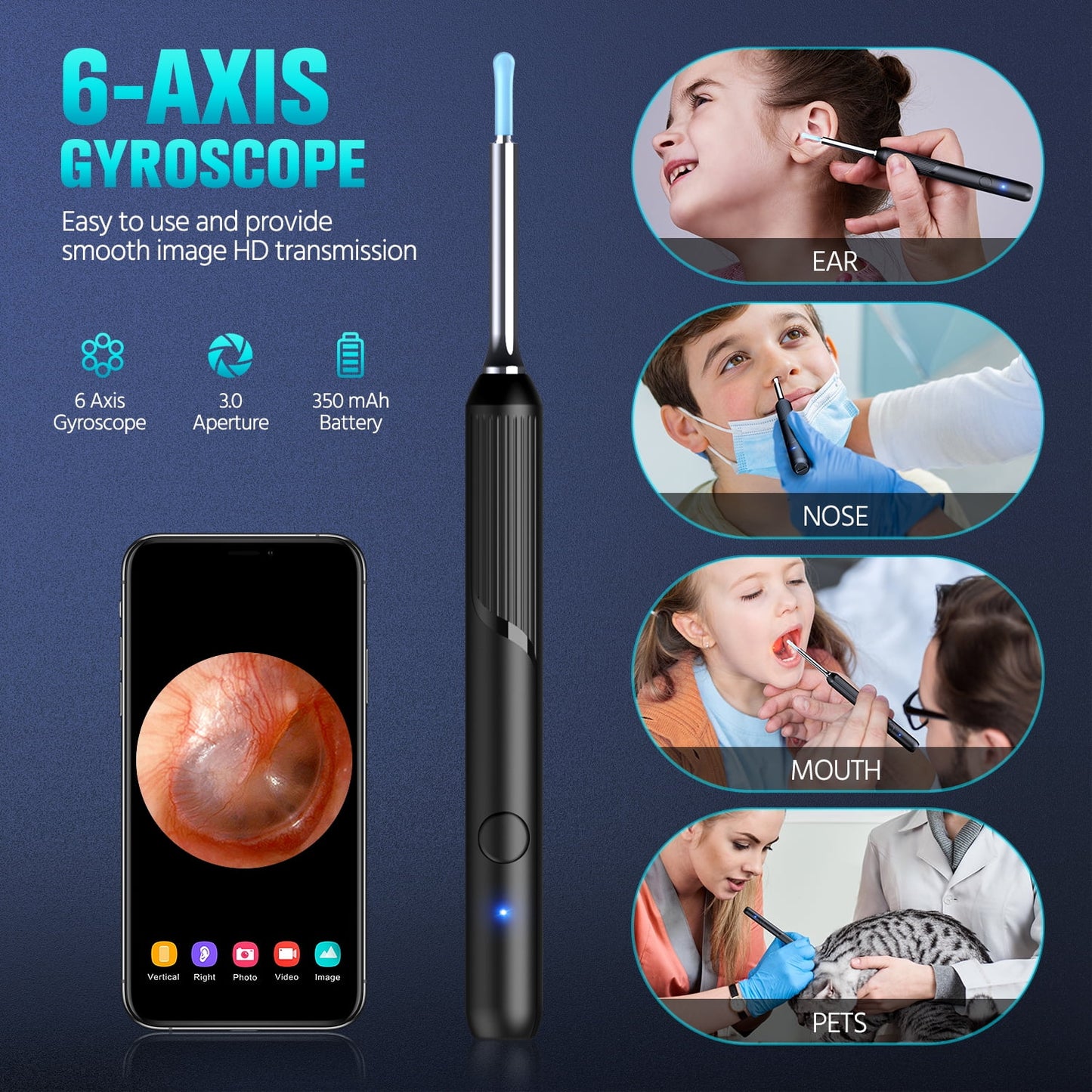 Aixiqee Ear Wax Removal, Ear Cleaner with 1080P HD Camera , Wirless Otoscope with 8 Pieces Set with Accessories