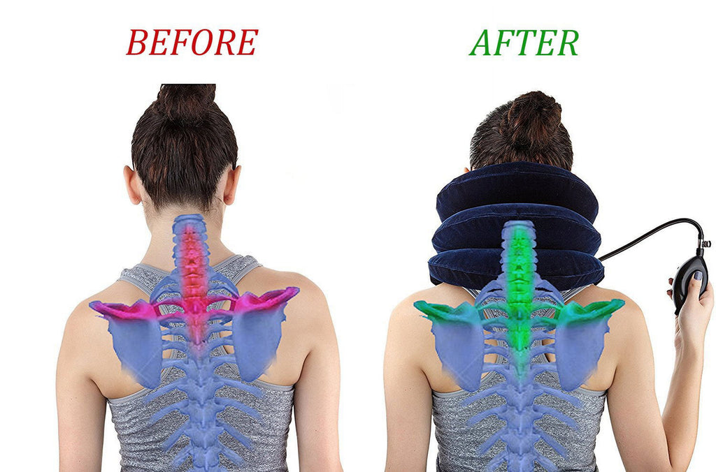 Cervical Neck Traction Device for Neck Pain Relief, Adjustable Inflatable Neck Stretcher Neck Brace, Neck Traction Pillow for Use Neck Decompression and Neck Tension Relief