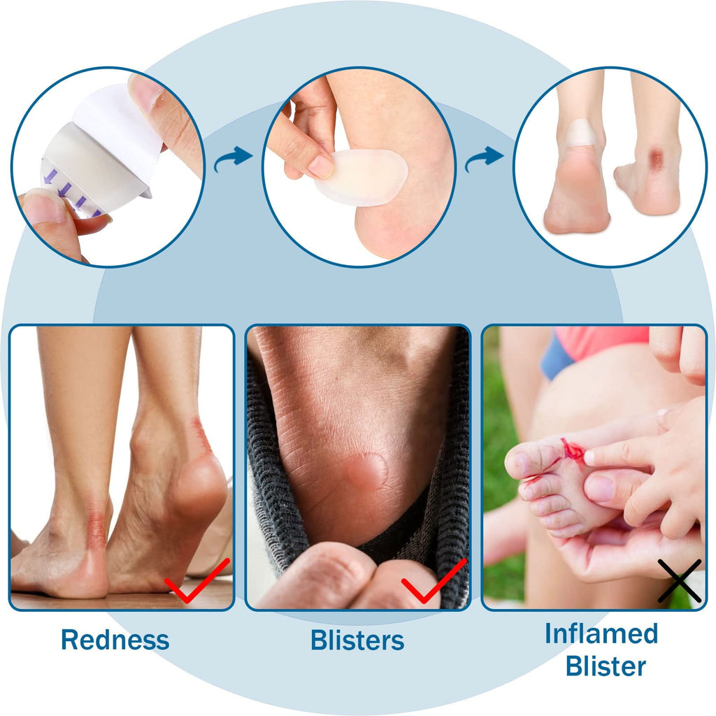 100 Pcs Blister Bandages Hydrocolloid Blister Pads for Heel Waterproof Adhesive Bandages Gel Blister Patches Protectors for Feet Toes Blister Prevention (Single Style)