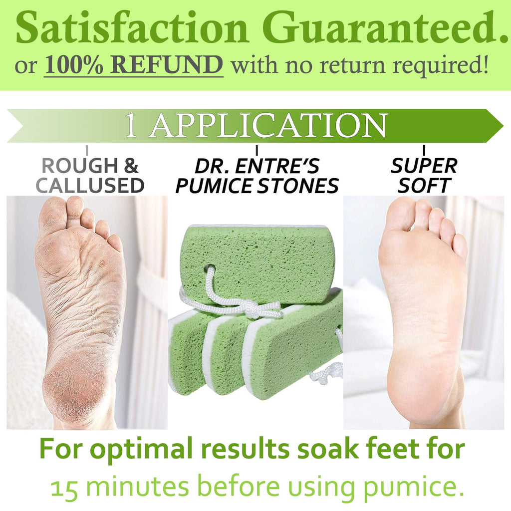 TIFOR Pumice Stone for Feet 4 Pack: Callus Remover, Dead Skin Scraper, Exfoliator for Shower Scrubber Use, Pedicure Tools, Cracked Heels Foot Care TIFOR